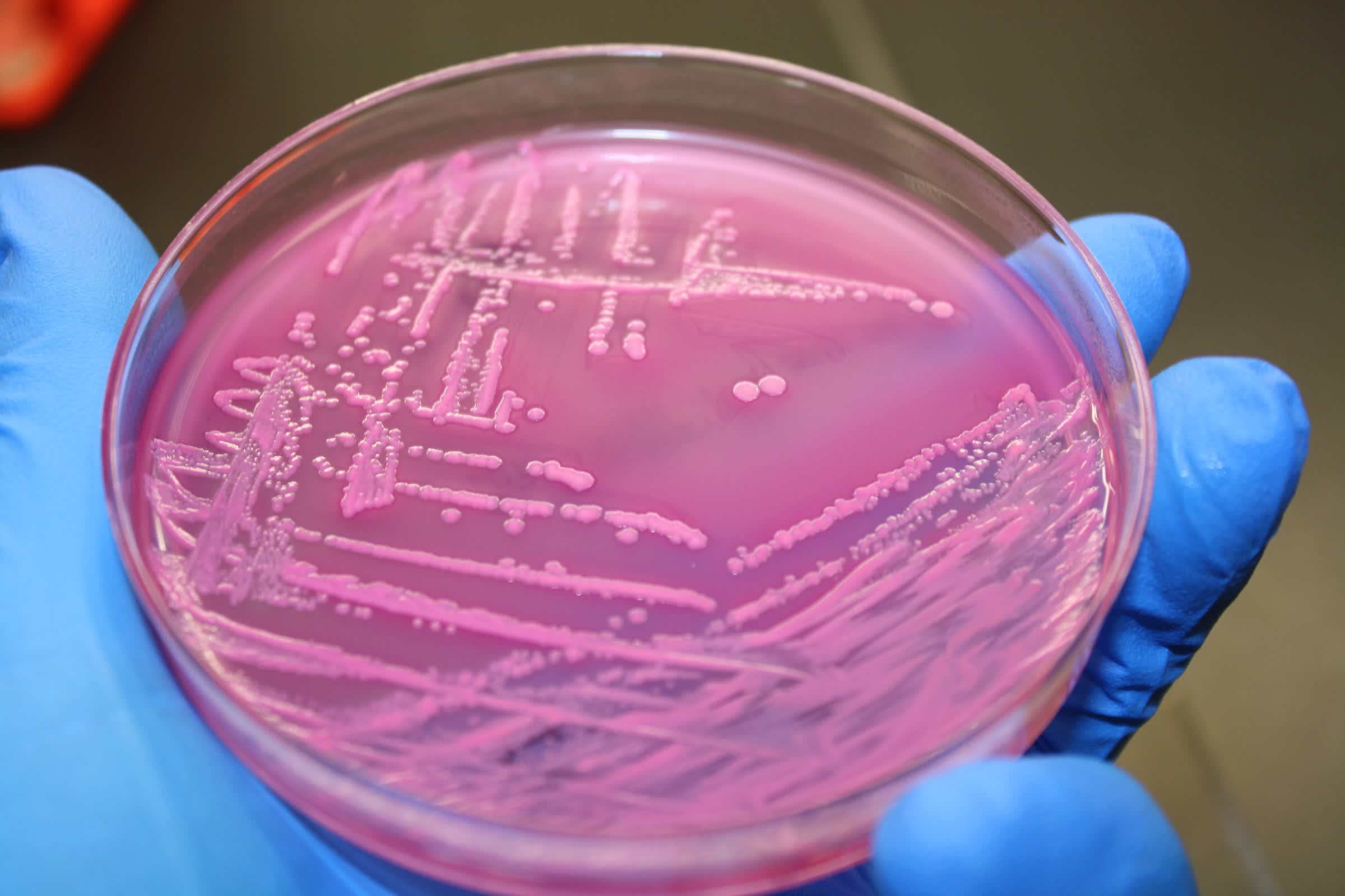 Oamenii de știință au infectat bacterii în spațiu – și evoluția a urmat un nou drum